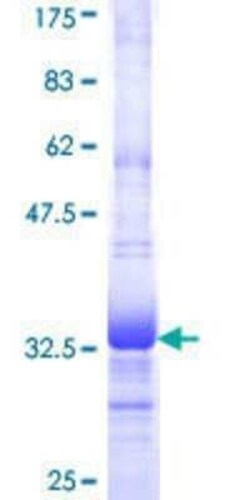 Novus Biologicals Recombinant Human PPAP2C GST (N-Term) Protein 10 &mu;g | Buy Online | Novus Biologicals&trade; | Fisher Scientific