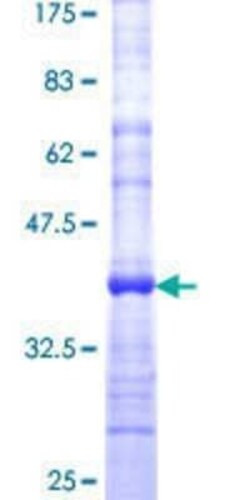 Novus Biologicals Recombinant Human CADPS GST (N-Term) Protein 25 &mu;g | Buy Online | Novus Biologicals&trade; | Fisher Scientific
