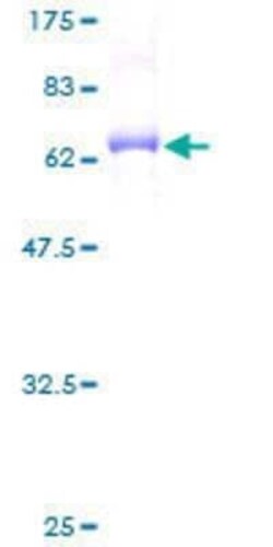 Novus Biologicals Recombinant Human CDC2L5 GST (N-Term) Protein 25 &mu;g | Buy Online | Novus Biologicals&trade; | Fisher Scientific