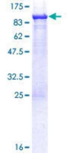 Novus Biologicals Recombinant Human ASMTL GST (N-Term) Protein 25 &mu;g | Buy Online | Novus Biologicals&trade; | Fisher Scientific