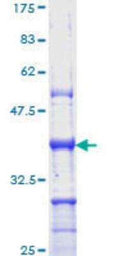 Novus Biologicals Recombinant Human p63/TP73L GST (N-Term) Protein 10 &mu;g | Buy Online | Novus Biologicals&trade; | Fisher Scientific