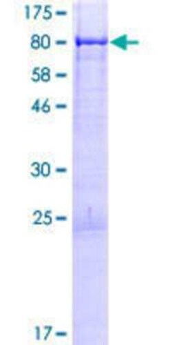 Novus Biologicals Recombinant Human JRK GST (N-Term) Protein 25 &mu;g | Buy Online | Novus Biologicals&trade; | Fisher Scientific