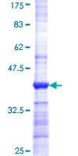 Novus Biologicals Recombinant Human JRK GST (N-Term) Protein 10 &mu;g | Buy Online | Novus Biologicals&trade; | Fisher Scientific