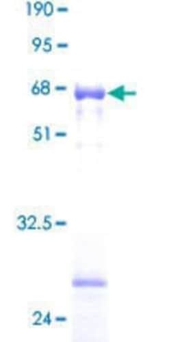Novus Biologicals Recombinant Human HSD17B6 GST (N-Term) Protein 2 &mu;g | Buy Online | Novus Biologicals&trade; | Fisher Scientific