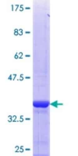 Novus Biologicals Recombinant Human HSD17B6 GST (N-Term) Protein 25 &mu;g | Buy Online | Novus Biologicals&trade; | Fisher Scientific