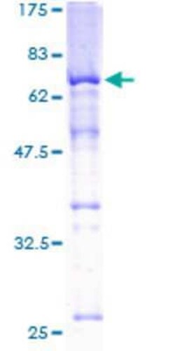 Novus Biologicals Recombinant Human SKAP55 GST (N-Term) Protein 2 &mu;g | Buy Online | Novus Biologicals&trade; | Fisher Scientific