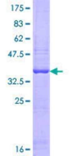 Novus Biologicals Recombinant Human OASL GST (N-Term) Protein 25 &mu;g | Buy Online | Novus Biologicals&trade; | Fisher Scientific