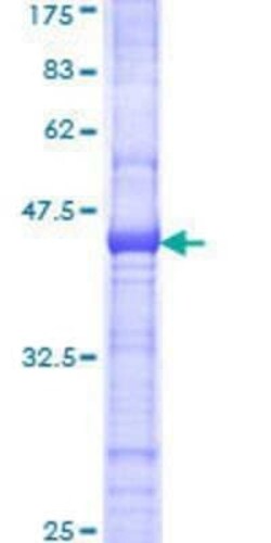 Novus Biologicals Recombinant Human PCDHGB4 GST (N-Term) Protein 10 &mu;g | Buy Online | Novus Biologicals&trade; | Fisher Scientific