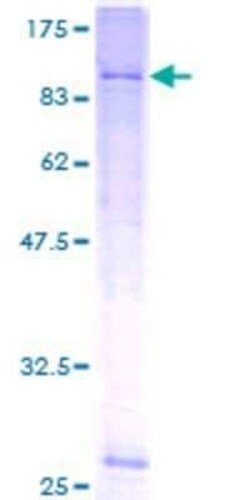 Novus Biologicals Recombinant Human KCNK5 GST (N-Term) Protein 2 &mu;g | Buy Online | Novus Biologicals&trade; | Fisher Scientific