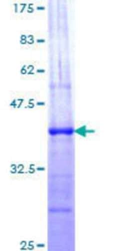 Novus Biologicals Recombinant Human SRC1 GST (N-Term) Protein 10 &mu;g | Buy Online | Novus Biologicals&trade; | Fisher Scientific