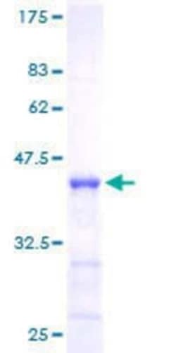 Novus Biologicals Recombinant Human Numb GST (N-Term) Protein 25 &mu;g | Buy Online | Novus Biologicals&trade; | Fisher Scientific