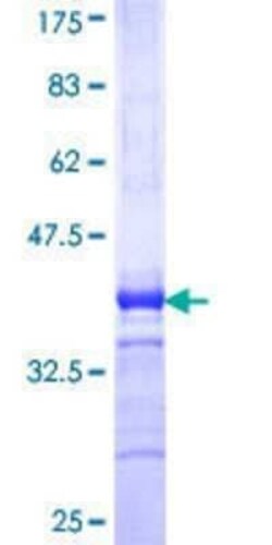 Novus Biologicals Recombinant Human DDX3Y GST (N-Term) Protein 10 &mu;g | Buy Online | Novus Biologicals&trade; | Fisher Scientific
