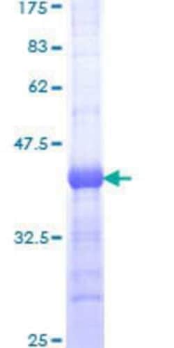 Novus Biologicals&trade;&nbsp;Recombinant Human PDE5A GST (N-Term) Protein