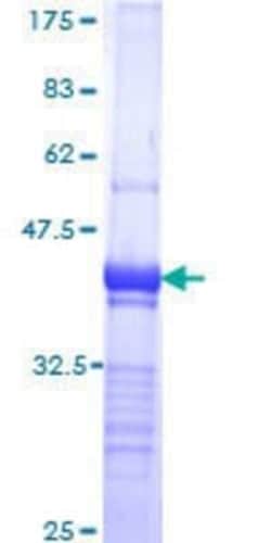Novus Biologicals Recombinant Human Tankyrase 1 GST (N-Term) Protein 25 &mu;g | Buy Online | Novus Biologicals&trade; | Fisher Scientific