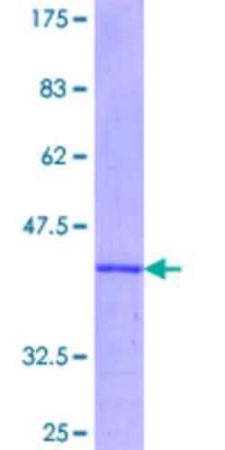 Novus Biologicals Recombinant Human IRS2 GST (N-Term) Protein 25 &mu;g | Buy Online | Novus Biologicals&trade; | Fisher Scientific