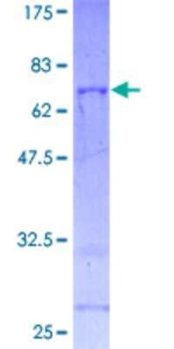 Novus Biologicals Recombinant Human EIF3G GST (N-Term) Protein 2 &mu;g | Buy Online | Novus Biologicals&trade; | Fisher Scientific