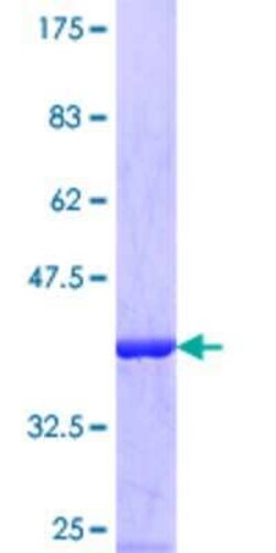 Novus Biologicals Recombinant Human EIF3G GST (N-Term) Protein 10 &mu;g | Buy Online | Novus Biologicals&trade; | Fisher Scientific