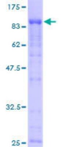 Novus Biologicals Recombinant Human eIF4GII GST (N-Term) Protein 25 &mu;g | Buy Online | Novus Biologicals&trade; | Fisher Scientific