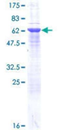 Novus Biologicals Recombinant Human Syntaxin 16 GST (N-Term) Protein 25 &mu;g | Buy Online | Novus Biologicals&trade; | Fisher Scientific