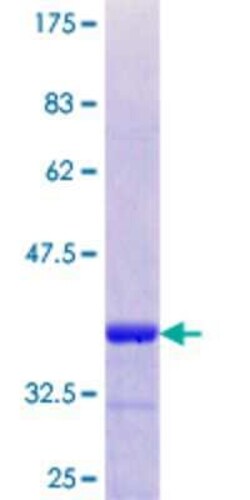Novus Biologicals Recombinant Human Syntaxin 16 GST (N-Term) Protein 10 &mu;g | Buy Online | Novus Biologicals&trade; | Fisher Scientific