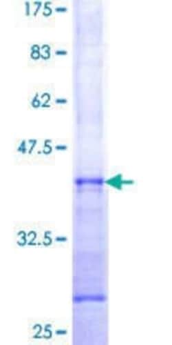 Novus Biologicals Recombinant Human STX10 GST (N-Term) Protein 10 &mu;g | Buy Online | Novus Biologicals&trade; | Fisher Scientific