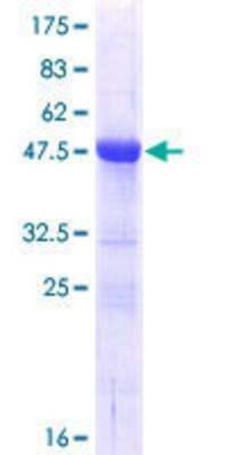 Novus Biologicals Recombinant Human SFRS9 GST (N-Term) Protein 10 &mu;g | Buy Online | Novus Biologicals&trade; | Fisher Scientific