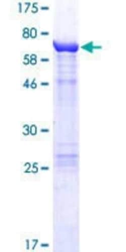 Novus Biologicals Recombinant Human Keratin 36 GST (N-Term) Protein 25 &mu;g | Buy Online | Novus Biologicals&trade; | Fisher Scientific