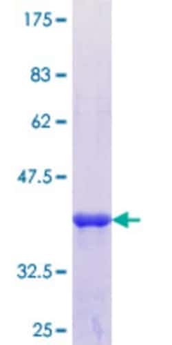 Novus Biologicals Recombinant Human Keratin 36 GST (N-Term) Protein 25 &mu;g | Buy Online | Novus Biologicals&trade; | Fisher Scientific