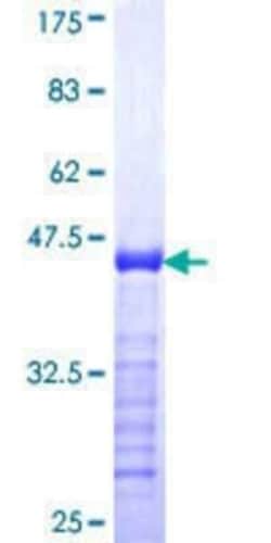 Novus Biologicals Recombinant Human HHMJG GST (N-Term) Protein 25 &mu;g | Buy Online | Novus Biologicals&trade; | Fisher Scientific