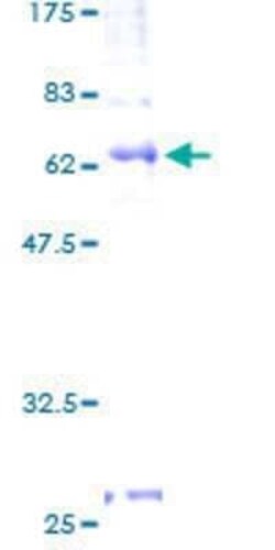 Novus Biologicals Recombinant Human S1P4/EDG-6 GST (N-Term) Protein 2 &mu;g | Buy Online | Novus Biologicals&trade; | Fisher Scientific