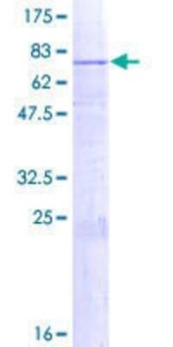 Novus Biologicals Recombinant Human B3GALT2 GST (N-Term) Protein 2 &mu;g | Buy Online | Novus Biologicals&trade; | Fisher Scientific
