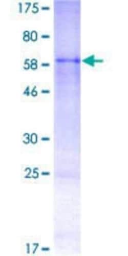 Novus Biologicals Recombinant Human B3GALT1 GST (N-Term) Protein 2 &mu;g | Buy Online | Novus Biologicals&trade; | Fisher Scientific