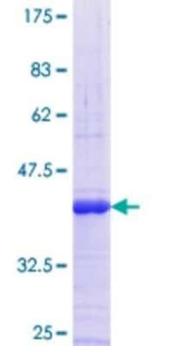 Novus Biologicals Recombinant Human B3GALT1 GST (N-Term) Protein 10 &mu;g | Buy Online | Novus Biologicals&trade; | Fisher Scientific