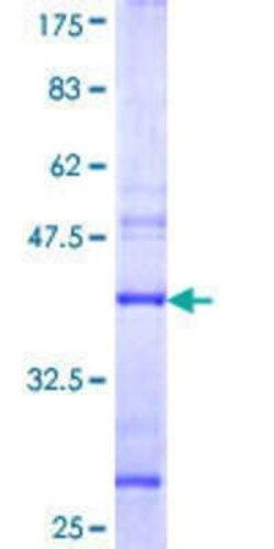 Novus Biologicals Recombinant Human Tnk1 GST (N-Term) Protein 25 &mu;g | Buy Online | Novus Biologicals&trade; | Fisher Scientific