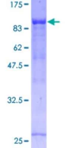 Novus Biologicals Recombinant Human NOL4 GST (N-Term) Protein 25 &mu;g | Buy Online | Novus Biologicals&trade; | Fisher Scientific