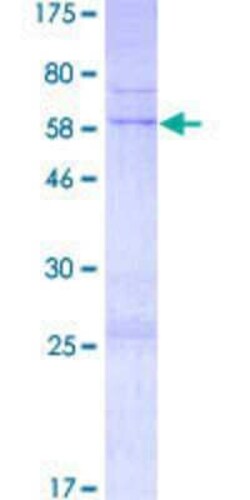 Novus Biologicals Recombinant Human TRADD GST (N-Term) Protein 2 &mu;g | Buy Online | Novus Biologicals&trade; | Fisher Scientific