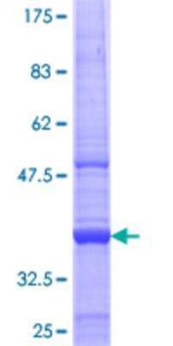 Novus Biologicals Recombinant Human MBTPS1 GST (N-Term) Protein 25 &mu;g | Buy Online | Novus Biologicals&trade; | Fisher Scientific