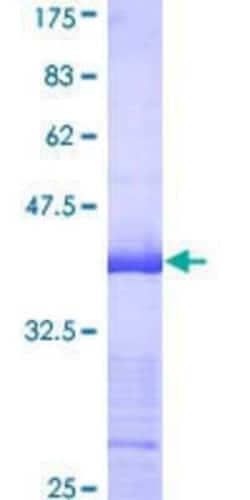 Novus Biologicals Recombinant Human SNX4 GST (N-Term) Protein 10 &mu;g | Buy Online | Novus Biologicals&trade; | Fisher Scientific