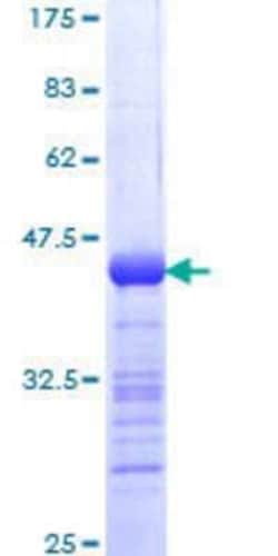 Novus Biologicals Recombinant Human URI GST (N-Term) Protein 25 &mu;g | Buy Online | Novus Biologicals&trade; | Fisher Scientific