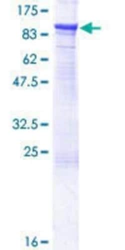 Novus Biologicals Recombinant Human CTNNAL1 GST (N-Term) Protein 25 &mu;g | Buy Online | Novus Biologicals&trade; | Fisher Scientific