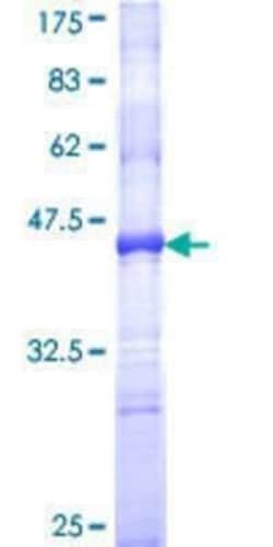 Novus Biologicals Recombinant Human CTNNAL1 GST (N-Term) Protein 10 &mu;g | Buy Online | Novus Biologicals&trade; | Fisher Scientific