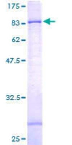 Novus Biologicals Recombinant Human GPAA1 GST (N-Term) Protein 25 &mu;g | Buy Online | Novus Biologicals&trade; | Fisher Scientific
