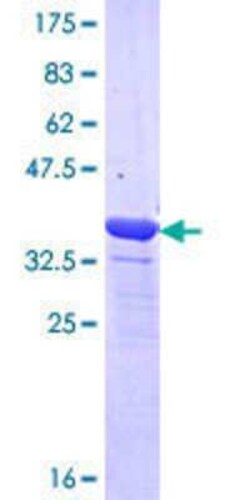 Novus Biologicals Recombinant Human MYOM1 GST (N-Term) Protein 25 &mu;g | Buy Online | Novus Biologicals&trade; | Fisher Scientific