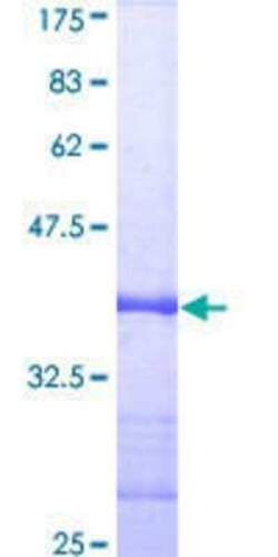 Novus Biologicals Recombinant Human RIPK1/RIP1 GST (N-Term) Protein 2 &mu;g | Buy Online | Novus Biologicals&trade; | Fisher Scientific