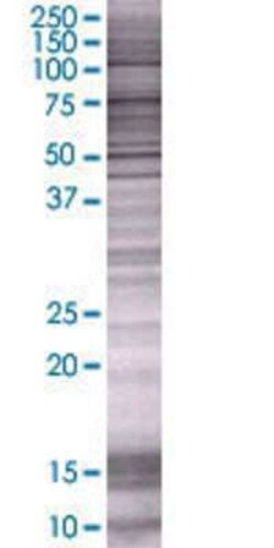 Novus Biologicals TWEAK/TNFSF12 293T Cell Transient Overexpression Lysate 0.1 mL | Buy Online | Novus Biologicals&trade; | Fisher Scientific