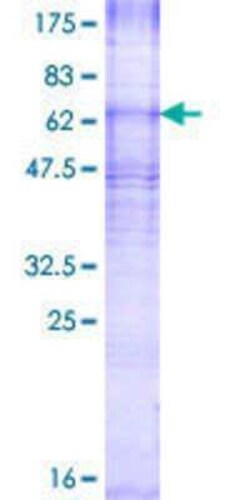 Novus Biologicals Recombinant Human CDS2 GST (N-Term) Protein 2 &mu;g | Buy Online | Novus Biologicals&trade; | Fisher Scientific