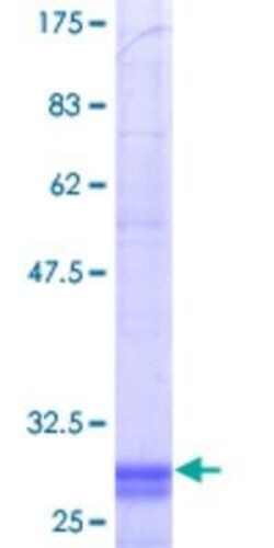 Novus Biologicals Recombinant Human MTMR1 GST (N-Term) Protein 10 &mu;g | Buy Online | Novus Biologicals&trade; | Fisher Scientific