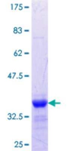 Novus Biologicals Recombinant Human MTMR1 GST (N-Term) Protein 25 &mu;g | Buy Online | Novus Biologicals&trade; | Fisher Scientific