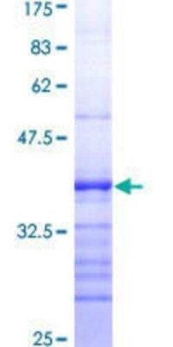 Novus Biologicals Recombinant Human RIOK3 GST (N-Term) Protein 25 &mu;g | Buy Online | Novus Biologicals&trade; | Fisher Scientific