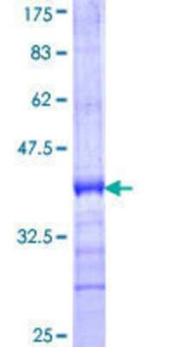 Novus Biologicals Recombinant Human RGS11 GST (N-Term) Protein 10 &mu;g | Buy Online | Novus Biologicals&trade; | Fisher Scientific